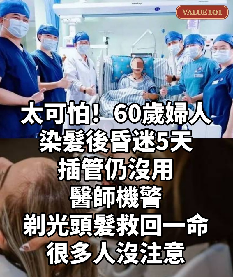 太可怕!60歲婦人「染髮後昏迷5天」插管仍沒用,醫師機警「剃光頭髮救回一命」:很多人沒注意
