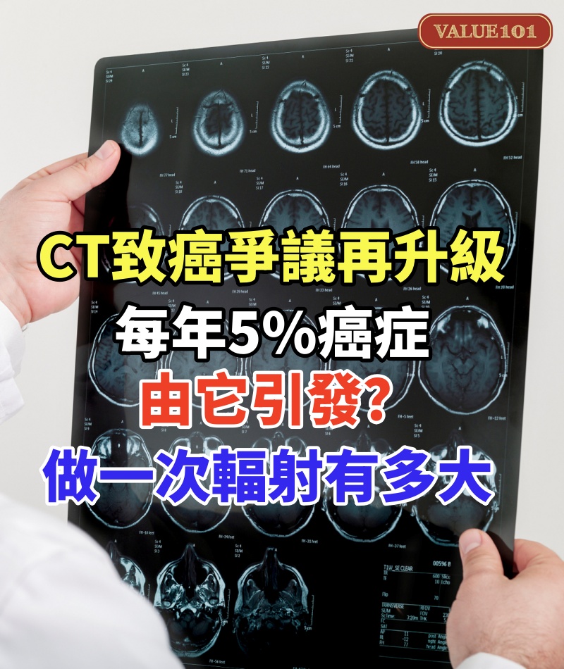 CT致癌爭議再升級：每年5%癌症由它引發？做一次CT的輻射有多大？