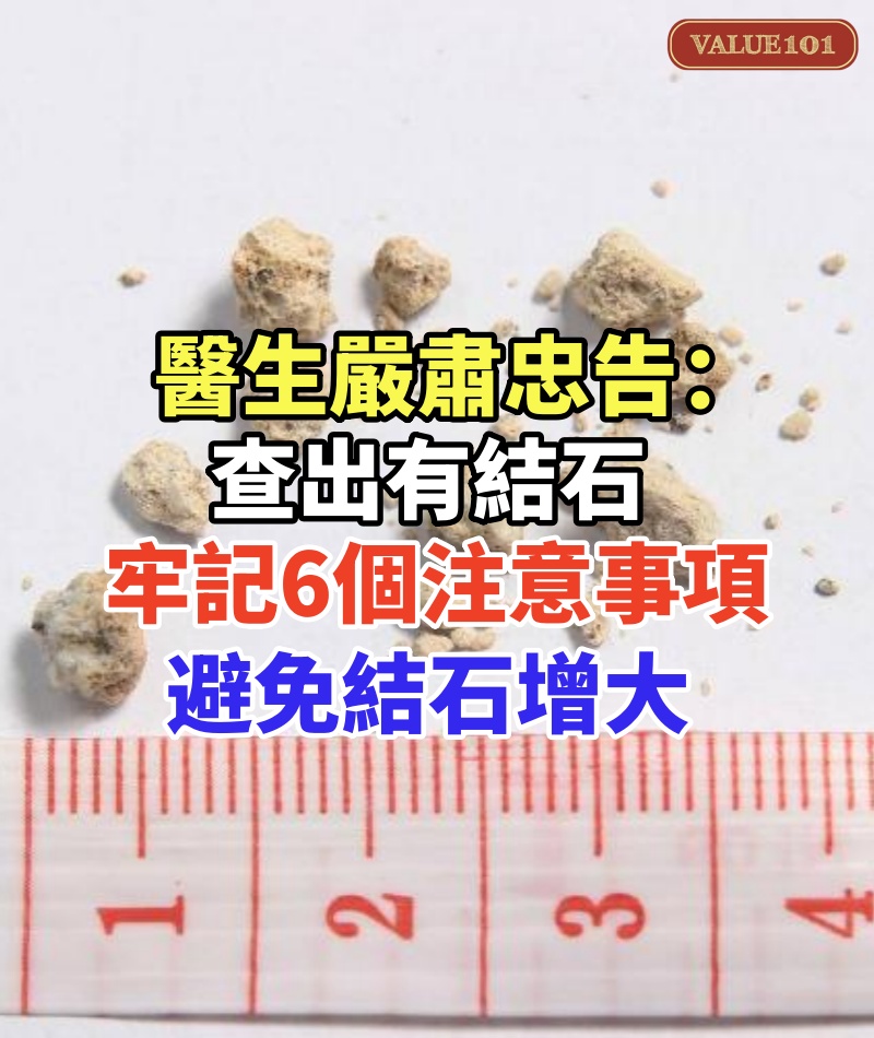 醫生嚴肅忠告:查出有結石,必須牢記6個注意事項,避免結石增大