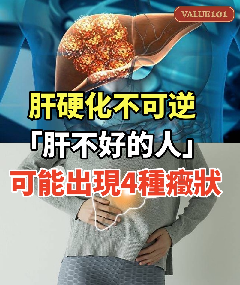 肝硬化不可逆!早上起床「肝不好的人」可能出現4種癥狀,若都沒有「恭喜肝還很健康」