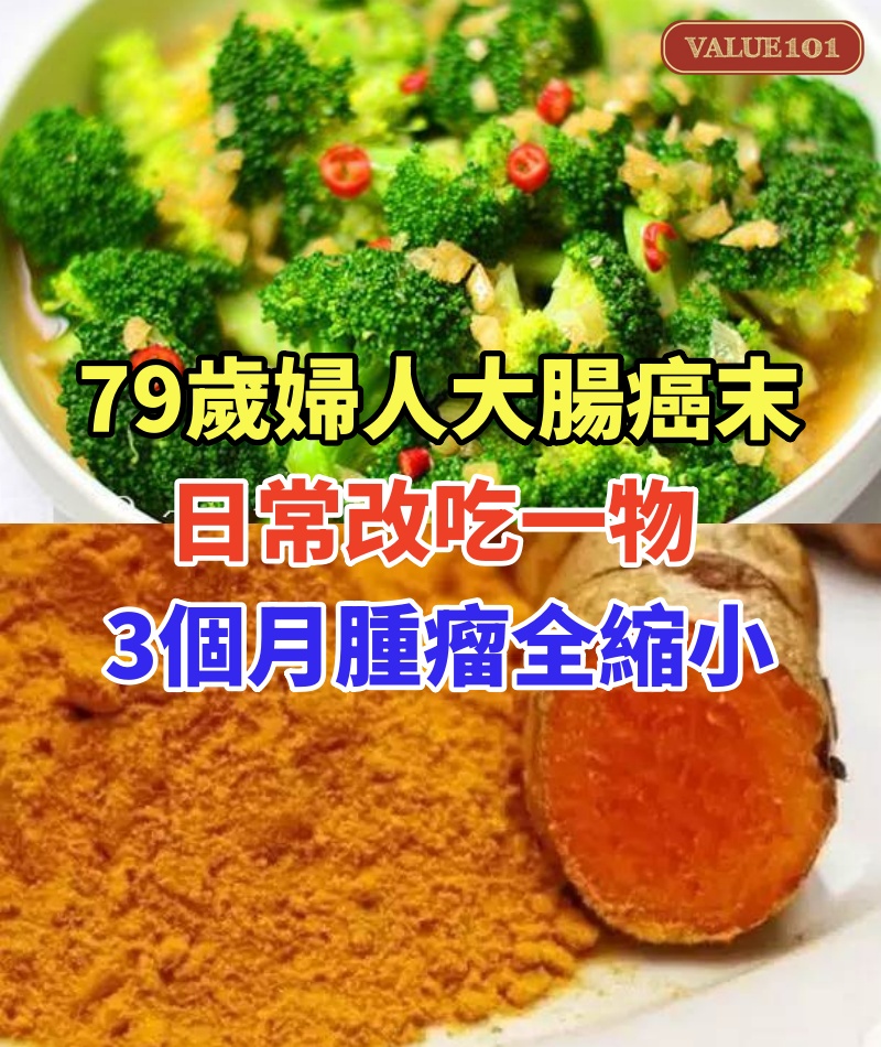 79歲婦人大腸癌末!化療太辛苦「放棄不治了」日常改吃一物「3個月腫瘤全縮小」醫生也看傻