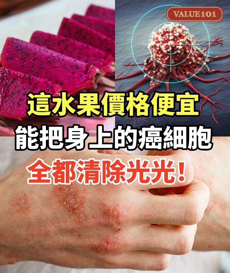 這水果價格便宜,卻能把身上的癌細胞全都清除光光!大腸癌、乳癌、卵巢癌都得靠它