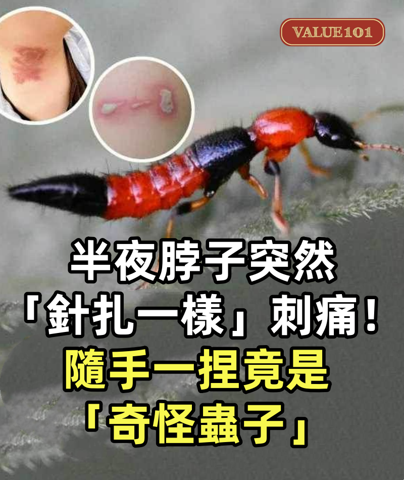 男子半夜脖子突然「針扎一樣」刺痛!隨手一捏竟是「奇怪蟲子」,眼尖網友提醒:快把你家床扔了!