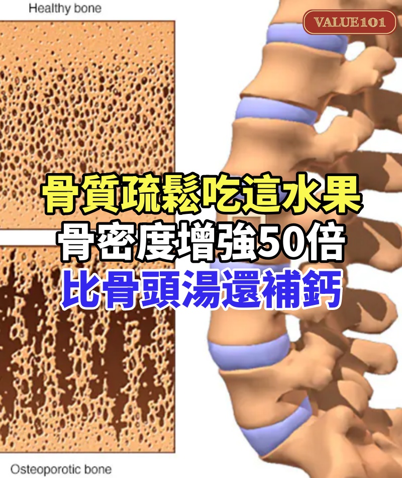 老了不想得骨質疏鬆,這水果每天早上吃1個,骨密度增強50倍,比骨頭湯還補鈣!到80歲走路還健步如飛!