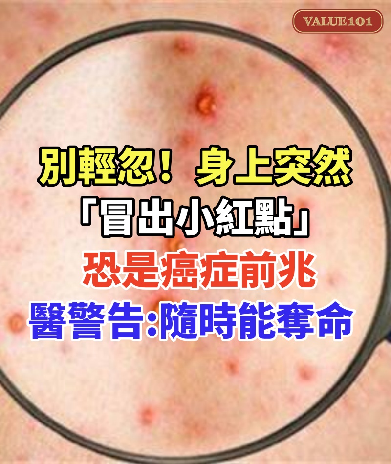 別輕忽!身上突然「冒出小紅點」:恐是癌症前兆 醫警告「像定時炸彈」隨時能奪命