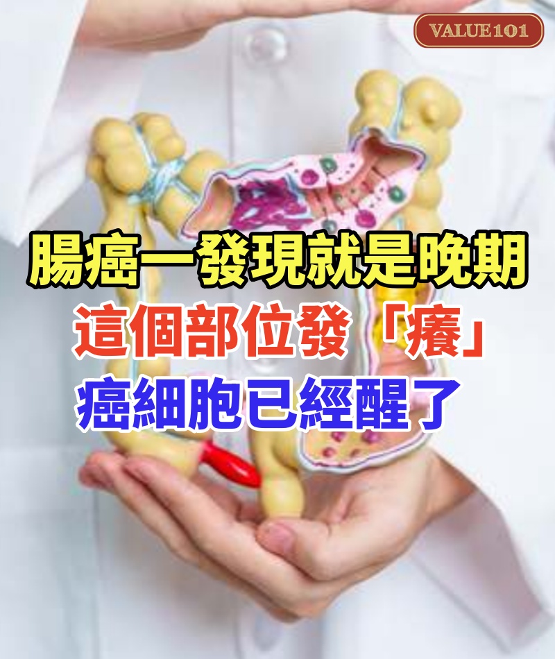 腸癌一發現就是晚期!一般身體這個部位發「癢」癌細胞已經醒了