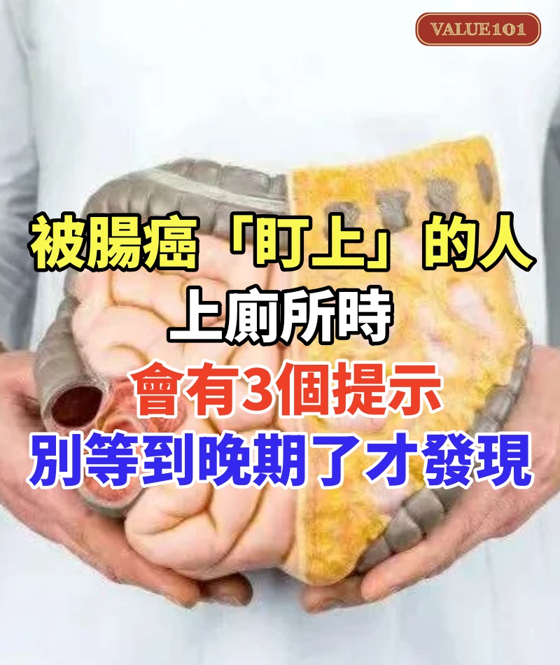 被腸癌「盯上」的人,上廁所時會有3個提示,別等到晚期了才發現!