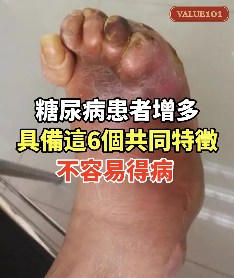 糖尿病患者增多!具備「這6個共同特徵」不容易得病 小細節做起「真的能降低風險」
