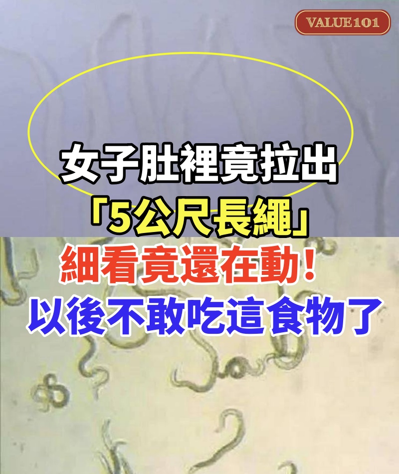 女子肚裡竟拉出「5公尺長繩」！細看竟還在動：以後不敢吃這食物了...