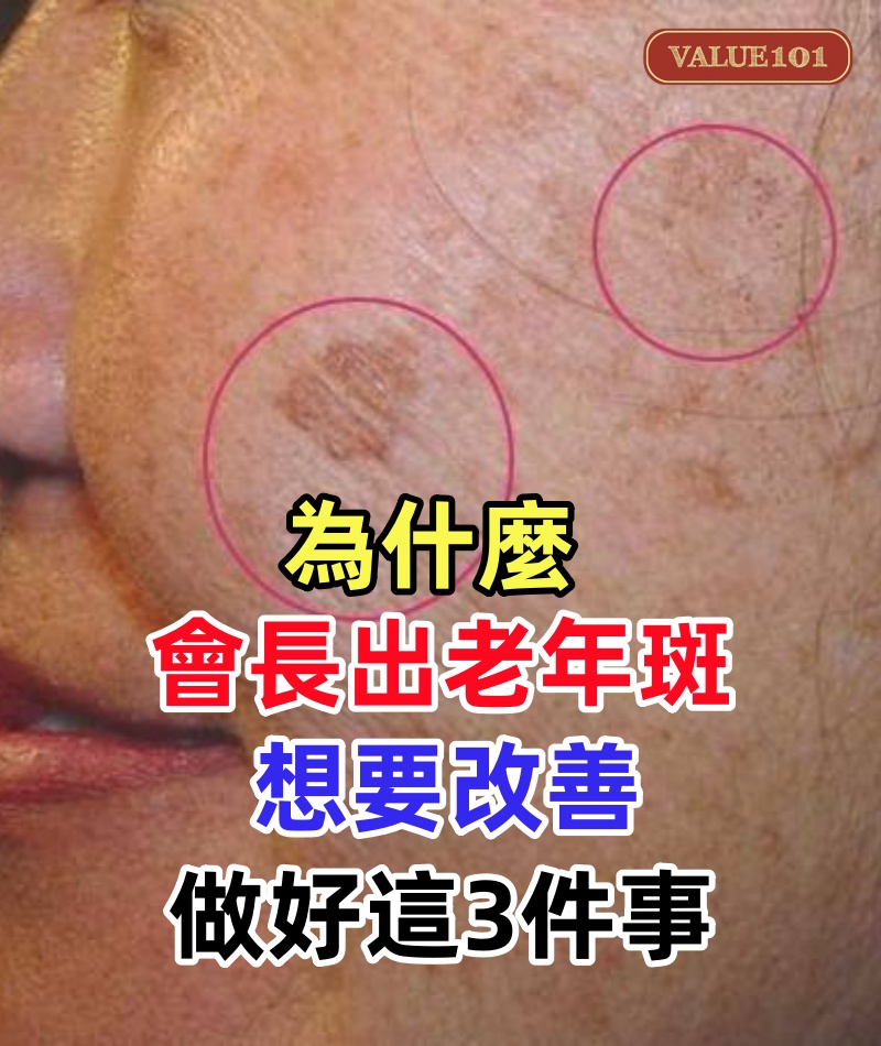 為什麼老年人身上會長出老年斑?想要改善,做好這3件事