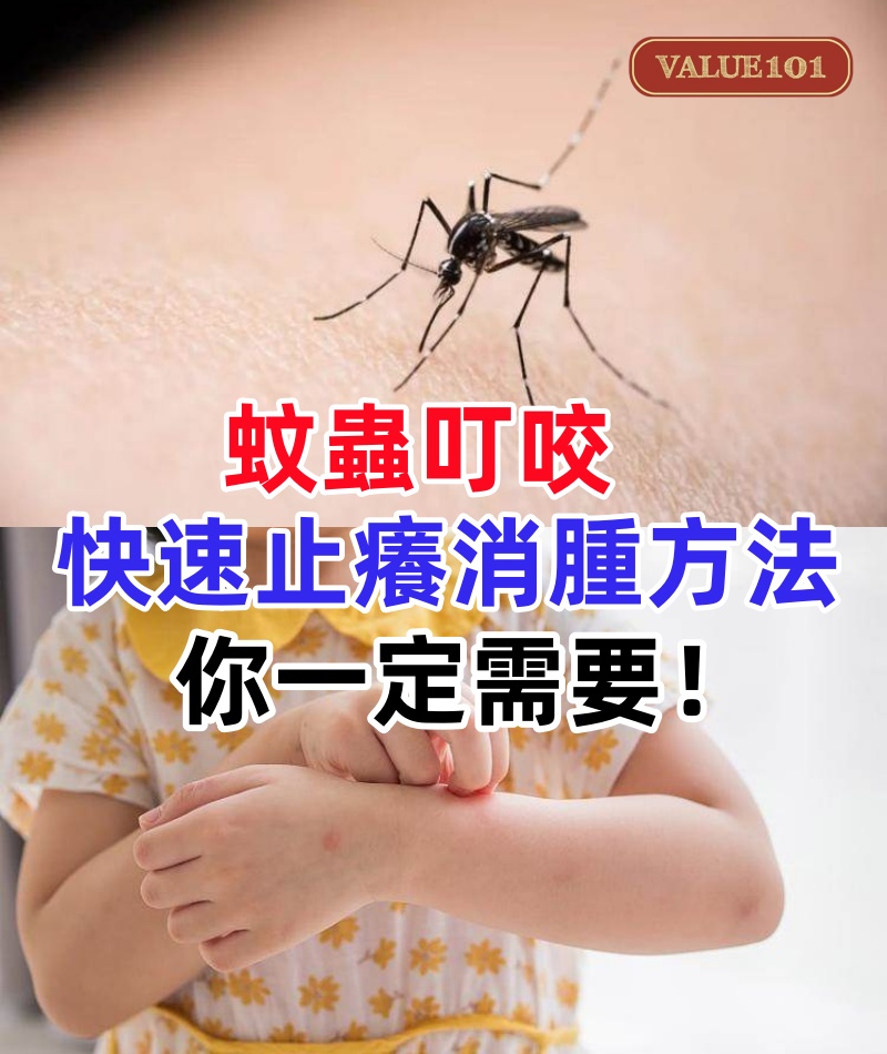 蚊蟲叮咬癢得受不了？快速止癢消腫的方法，你一定需要！