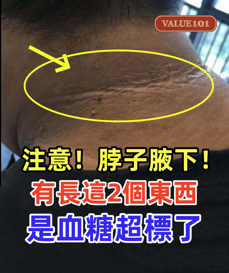 注意脖子、腋下! 如果有「長這2個東西」是血糖超標了