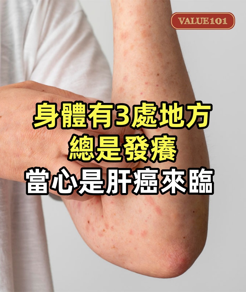身體有3處地方總是發癢，別以為是皮膚病，當心是肝癌來臨的預兆