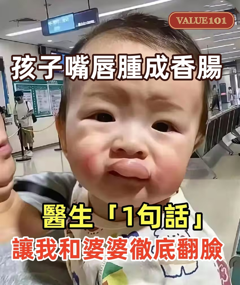 孩子交給婆婆帶半天,回家一看嘴唇腫成「香腸」!醫生「1句話」讓我和婆婆徹底翻臉