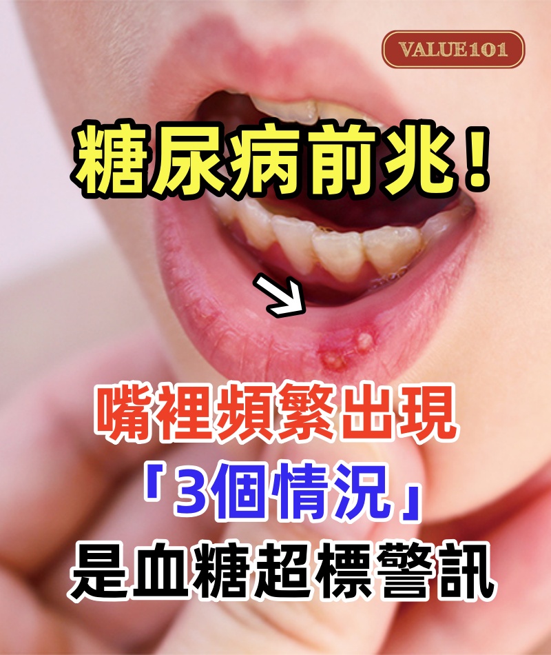 糖尿病前兆！ 嘴裡頻繁出現「3個情況」是血糖超標警訊