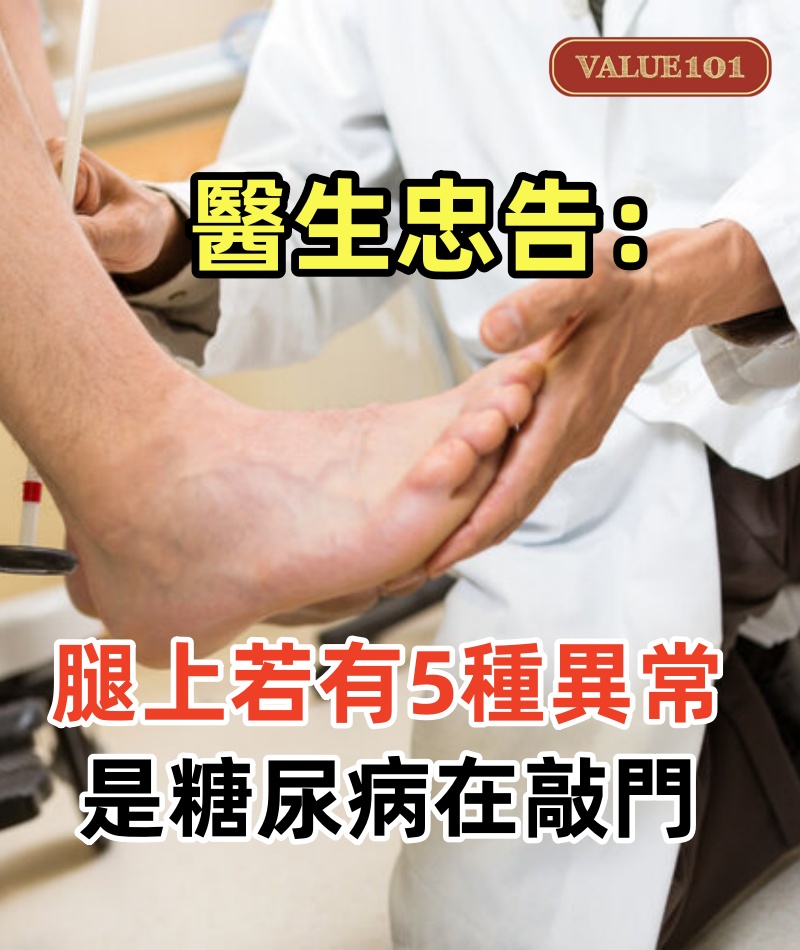 醫生忠告：腿上若有5種異常，可能是糖尿病在敲門？早發現早期介入