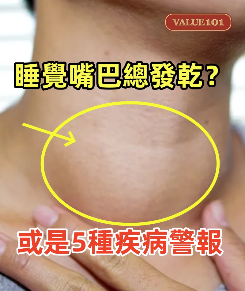 晚上睡覺嘴巴總是「發乾」？別以為是缺水，或是5種疾病「警報」.