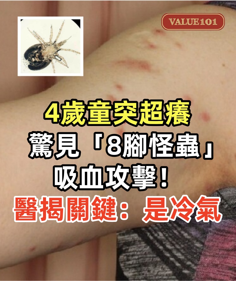 4歲童突超癢　驚見「8腳怪蟲」吸血攻擊！醫揭關鍵：是冷氣
