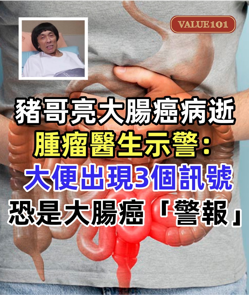 豬哥亮大腸癌70歲病逝！腫瘤醫生示警，大便出現3個訊號，恐是大腸癌「警報」
