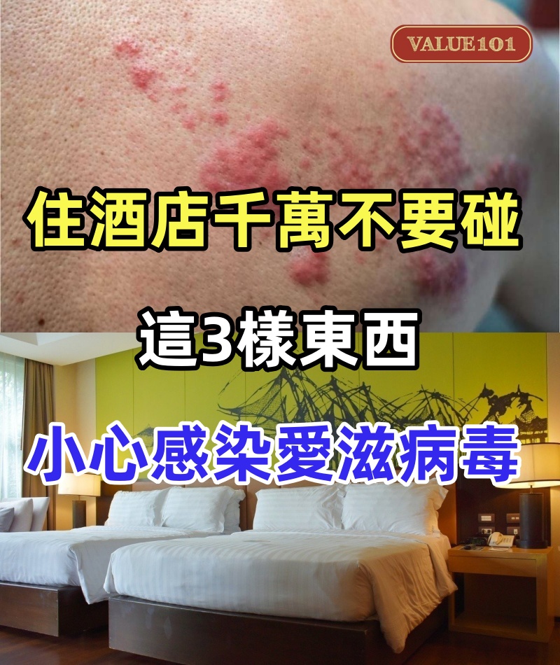 住酒店千萬不要碰這3樣東西，小心感染愛滋病毒！已有很多人中招!